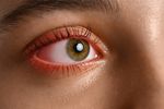 How Systemic Diseases Show Up in Your Eyes