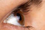 Early Signs and Symptoms of Keratoconus You Shouldn&rsquo;t Ignore
