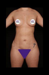Scottsdale Skinny After
