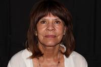 Facelift with Fat Transfer after