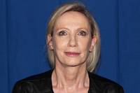 Facelift with Earlobe Repair after
