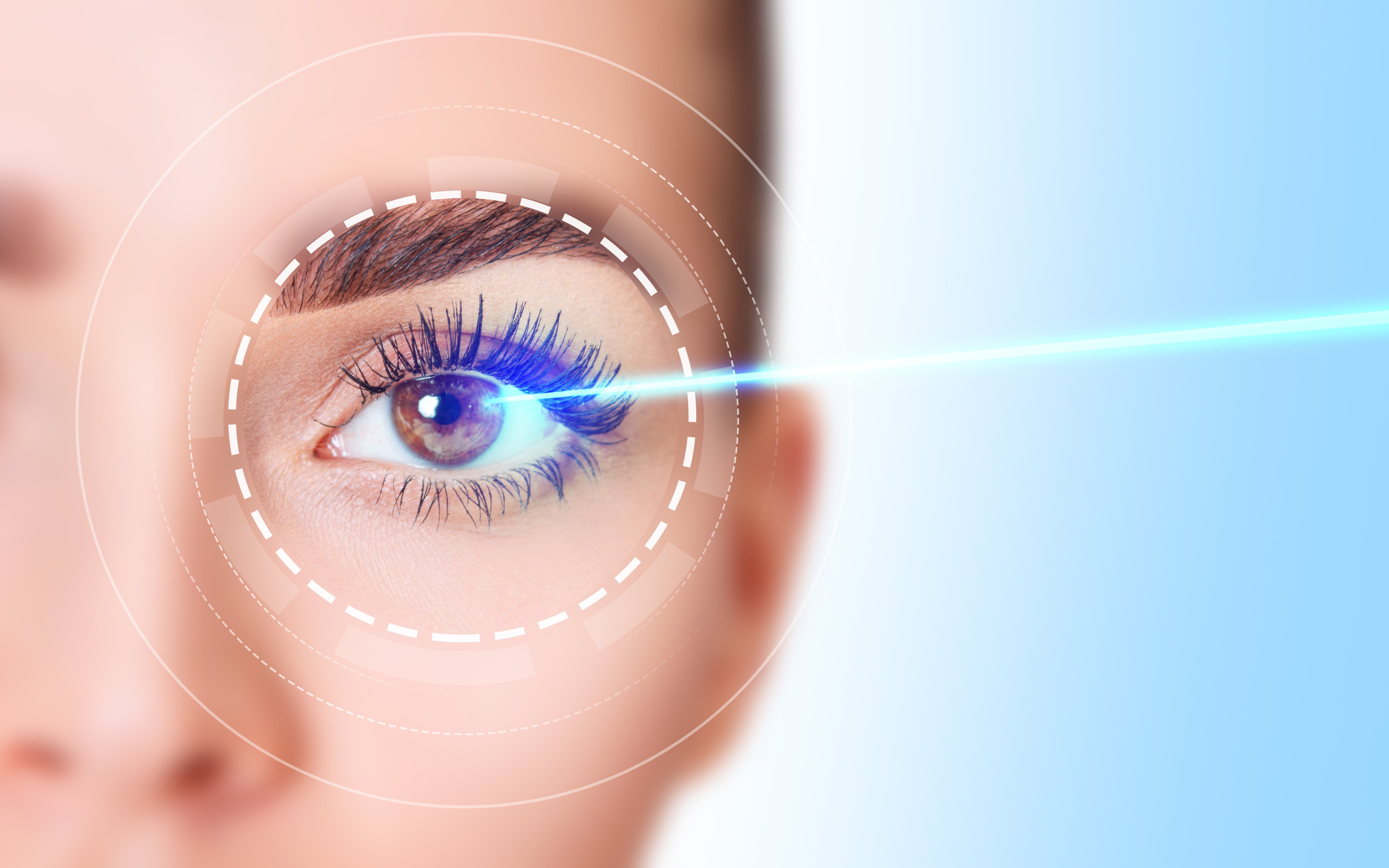 laser eye correction