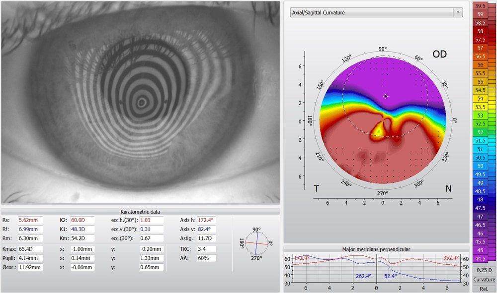 map of eye