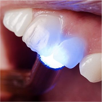 Restorative Dentistry