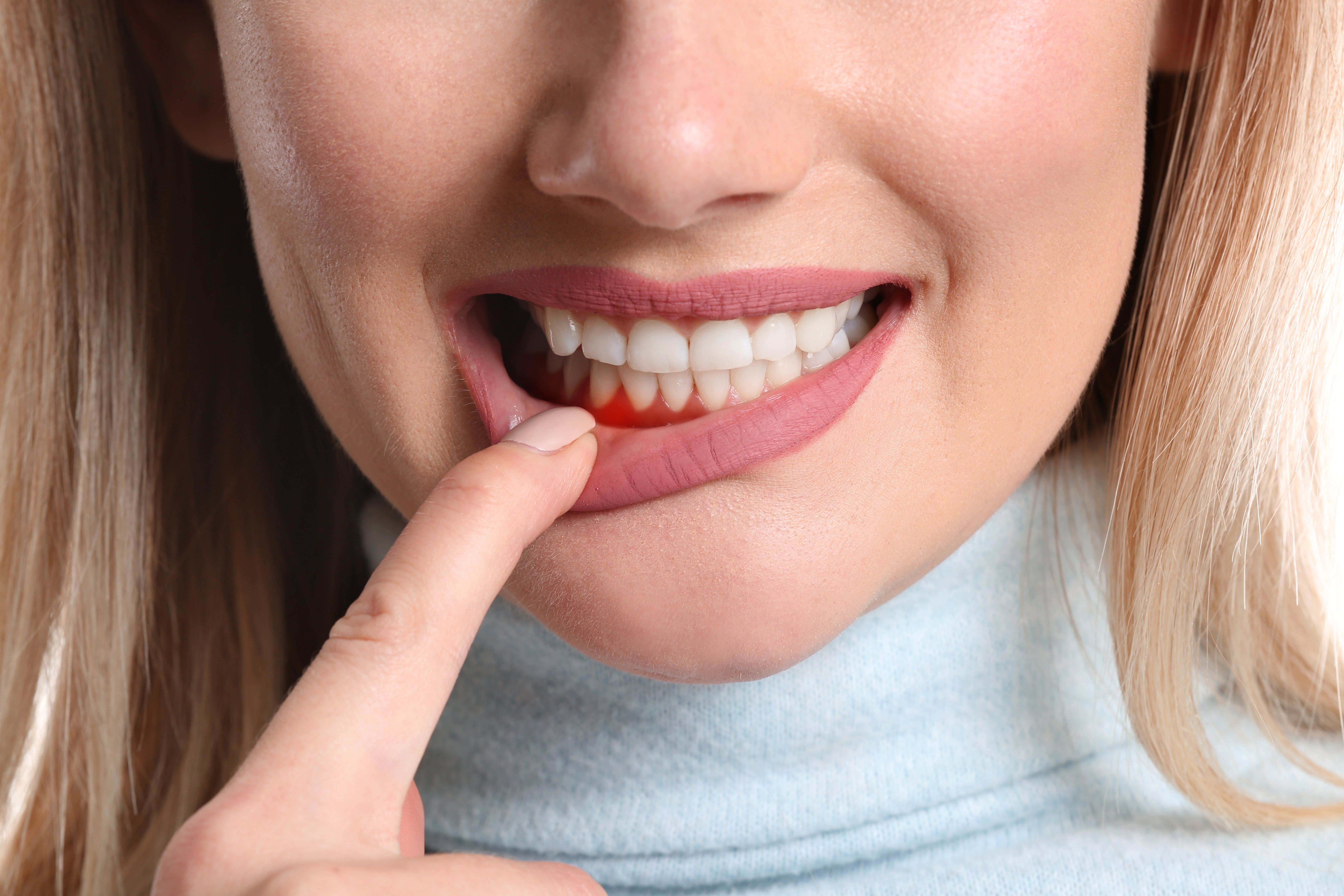gum disease and dental implants