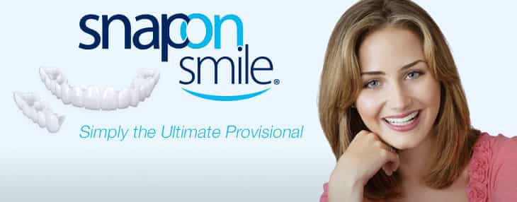 woman smiling with snap on smile