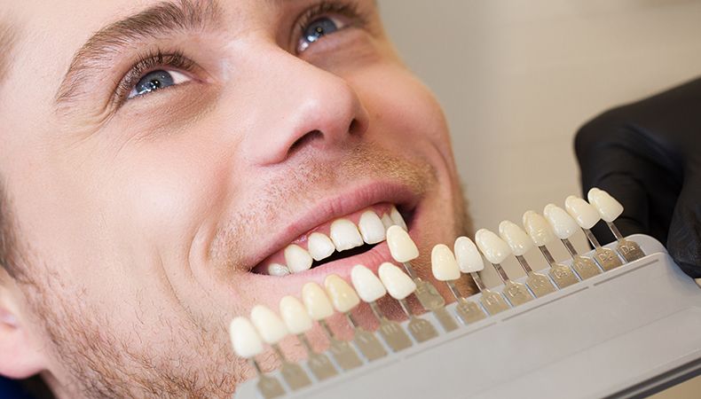 man being treated with dental veneers