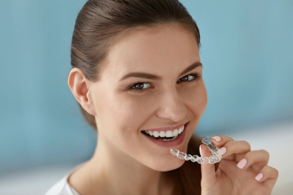 Advantages of Clear Aligners Over Braces