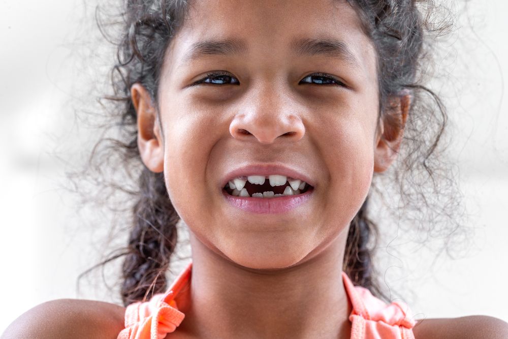 What to Do If Your Child Has a Cracked Tooth