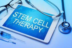 stem cell therapy