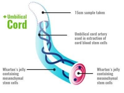 umbilical cord