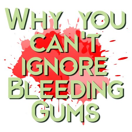 Bleeding Gums​​​​​​​