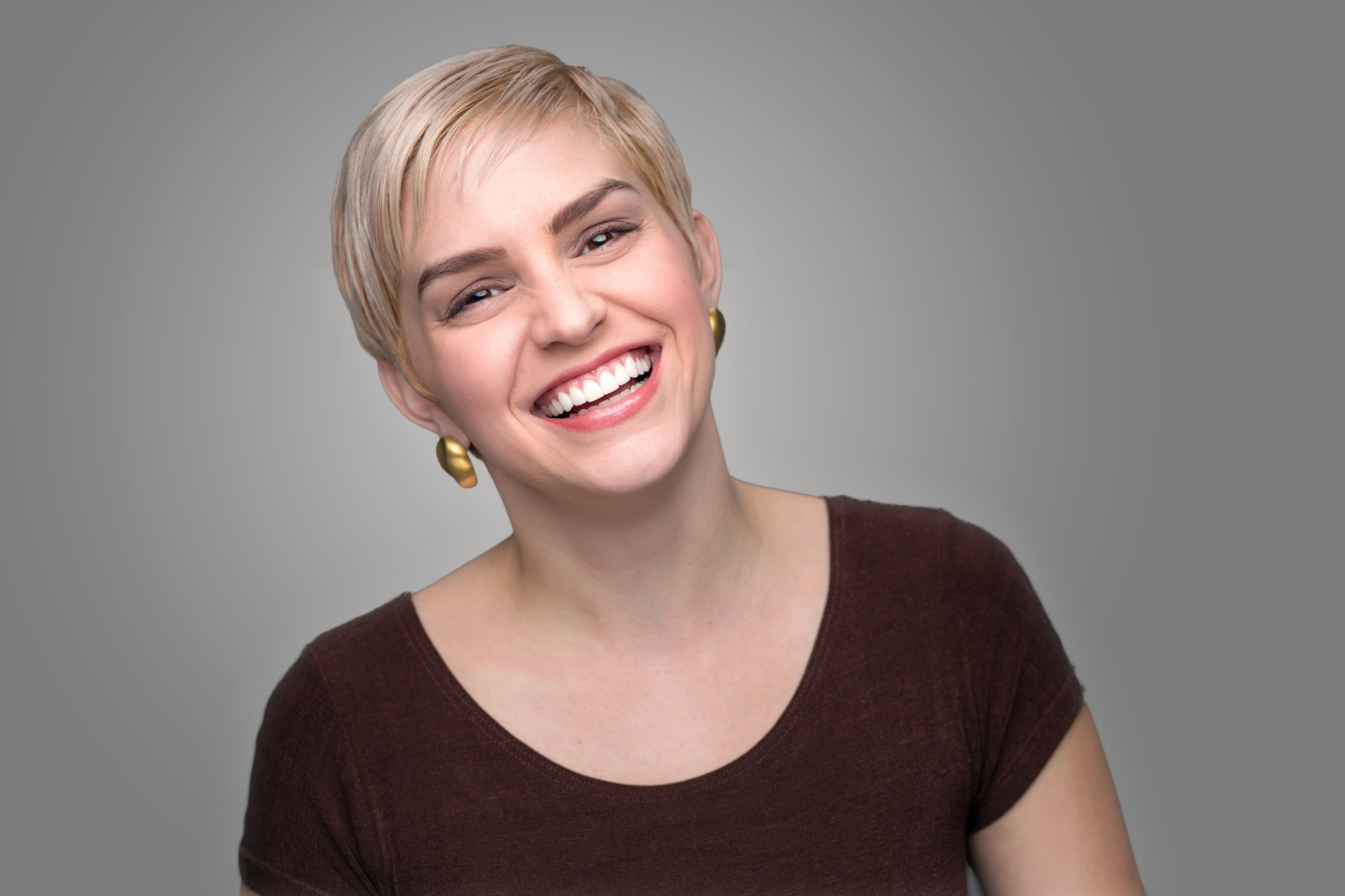 what are prepless veneers