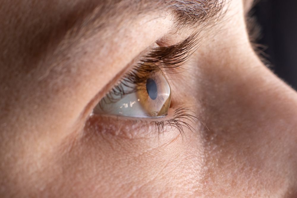 Keratoconus and Quality of Life: How Treatment Options Can Enhance Daily Living