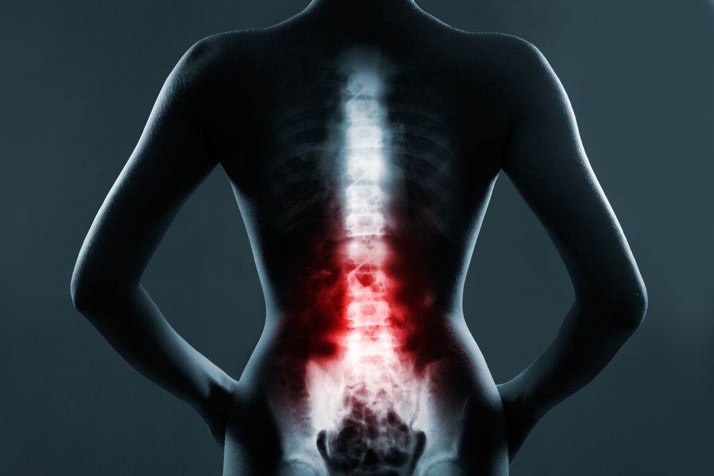 The Connection Between Spinal Health and Weight Management