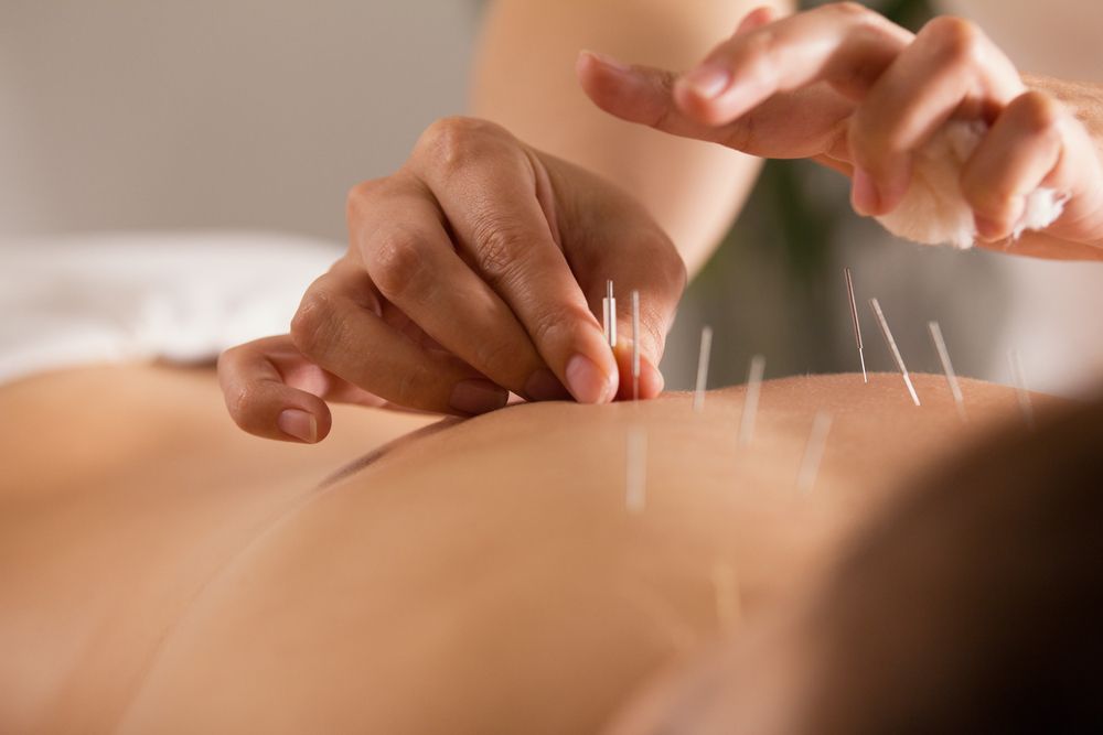 How Does Acupuncture Work to Relieve Pain?