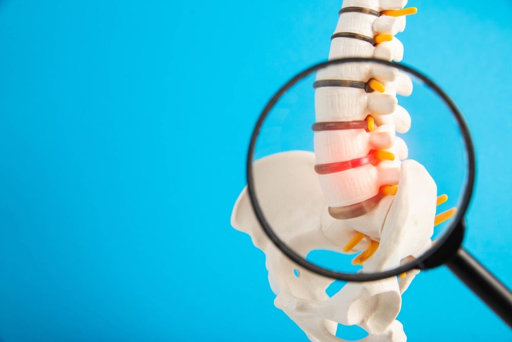 Combating Spinal Osteoporosis: How Chiropractic Care Can Make a Difference