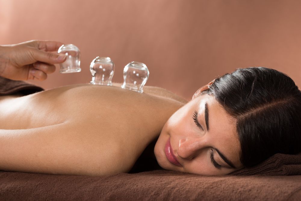 What to Expect at a Myofascial Cupping Appointment