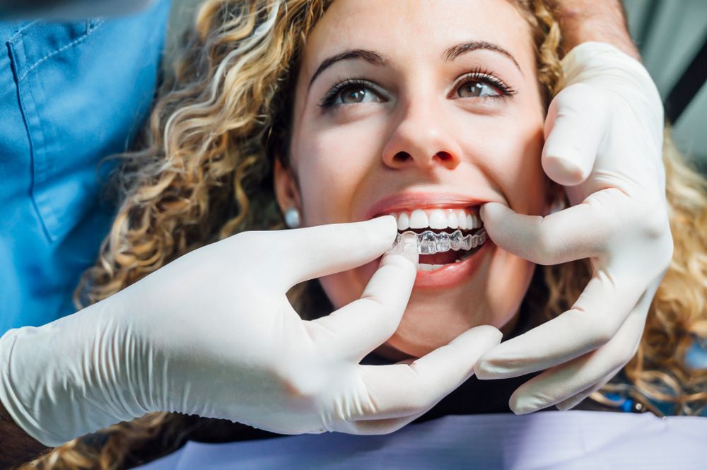 What Sets Invisalign Apart from Traditional Braces?