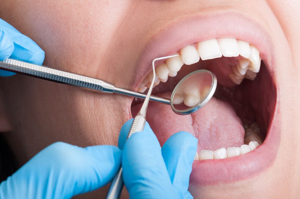 The Importance of Regular Dental Checkups and Cleanings