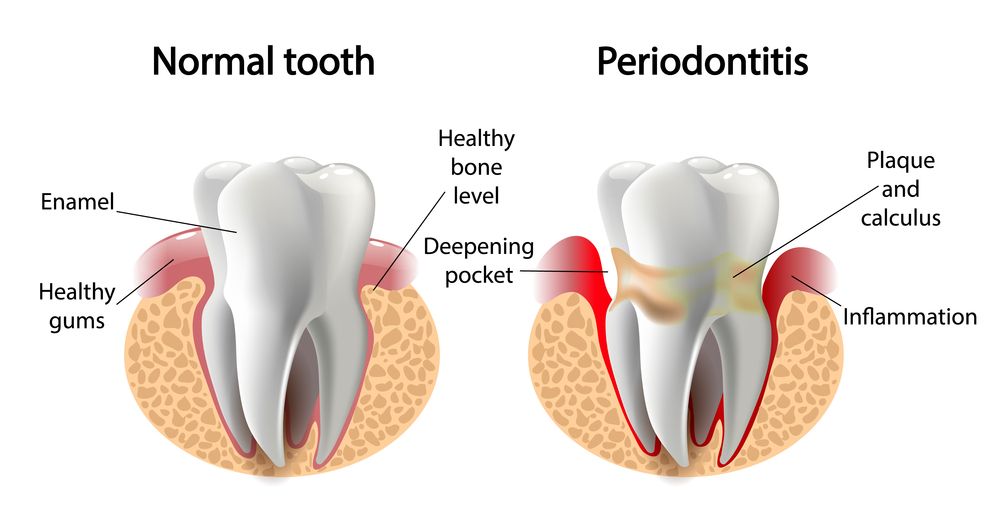 What Does a Periodontist Do that a Dentist Doesn’t?