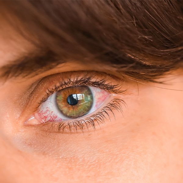 Optometrist in Greenville Blue Rose Eye Care