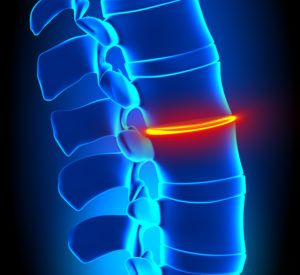 Lower Back Disc Pain and How Chiropractic Care Can Help