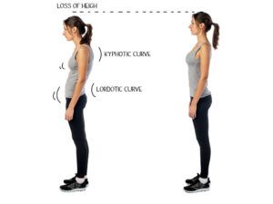 5 Tips To Improve Your Posture