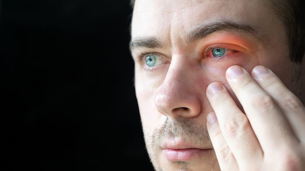 Can an Eye Infection Go Away on Its Own?