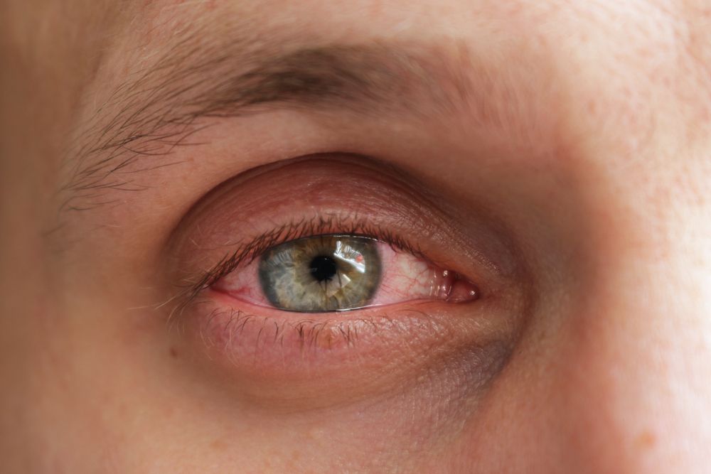 Common Eye Problems and How We Solve Them