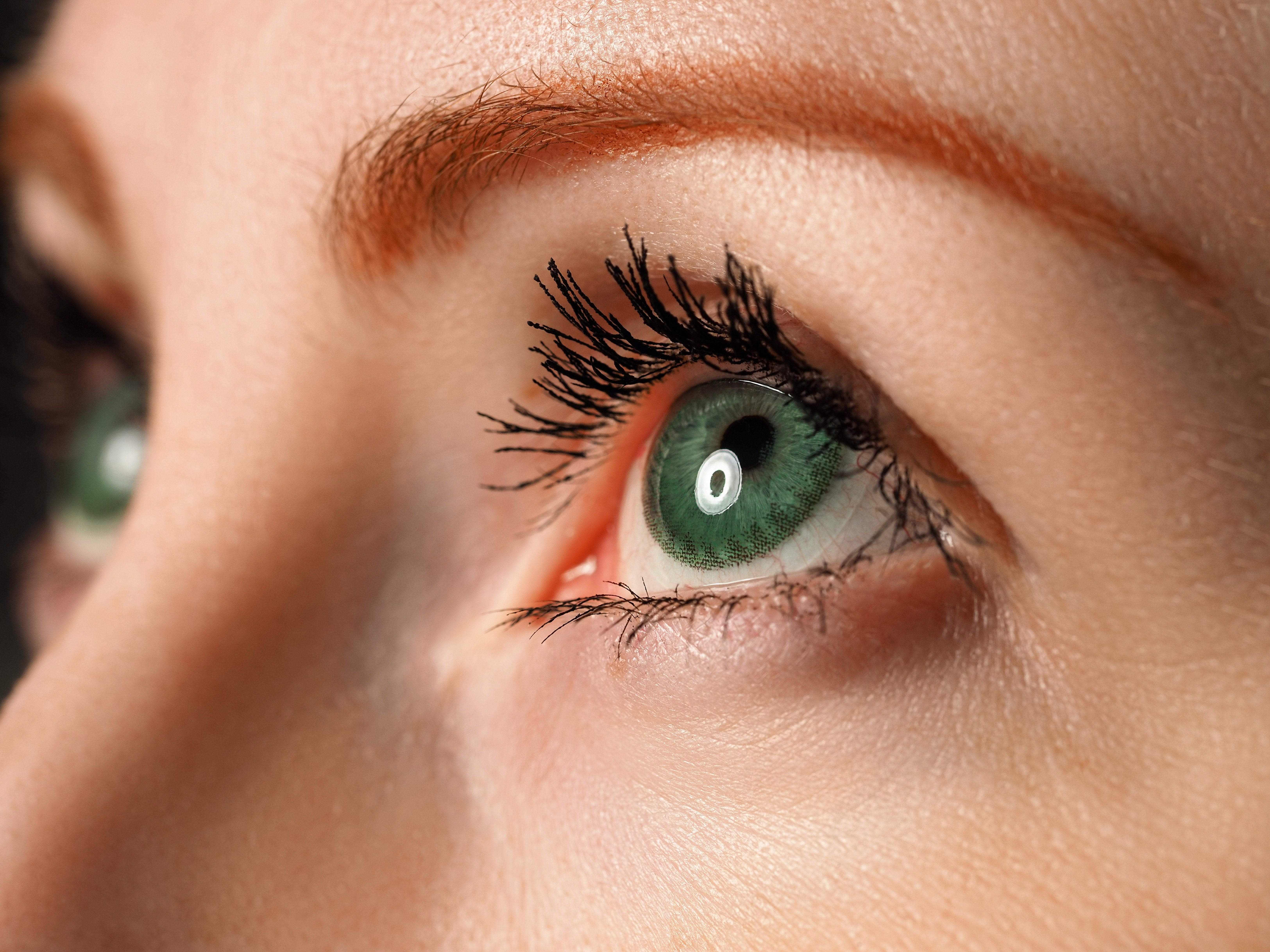 Eye Emergencies From Colored Contacts