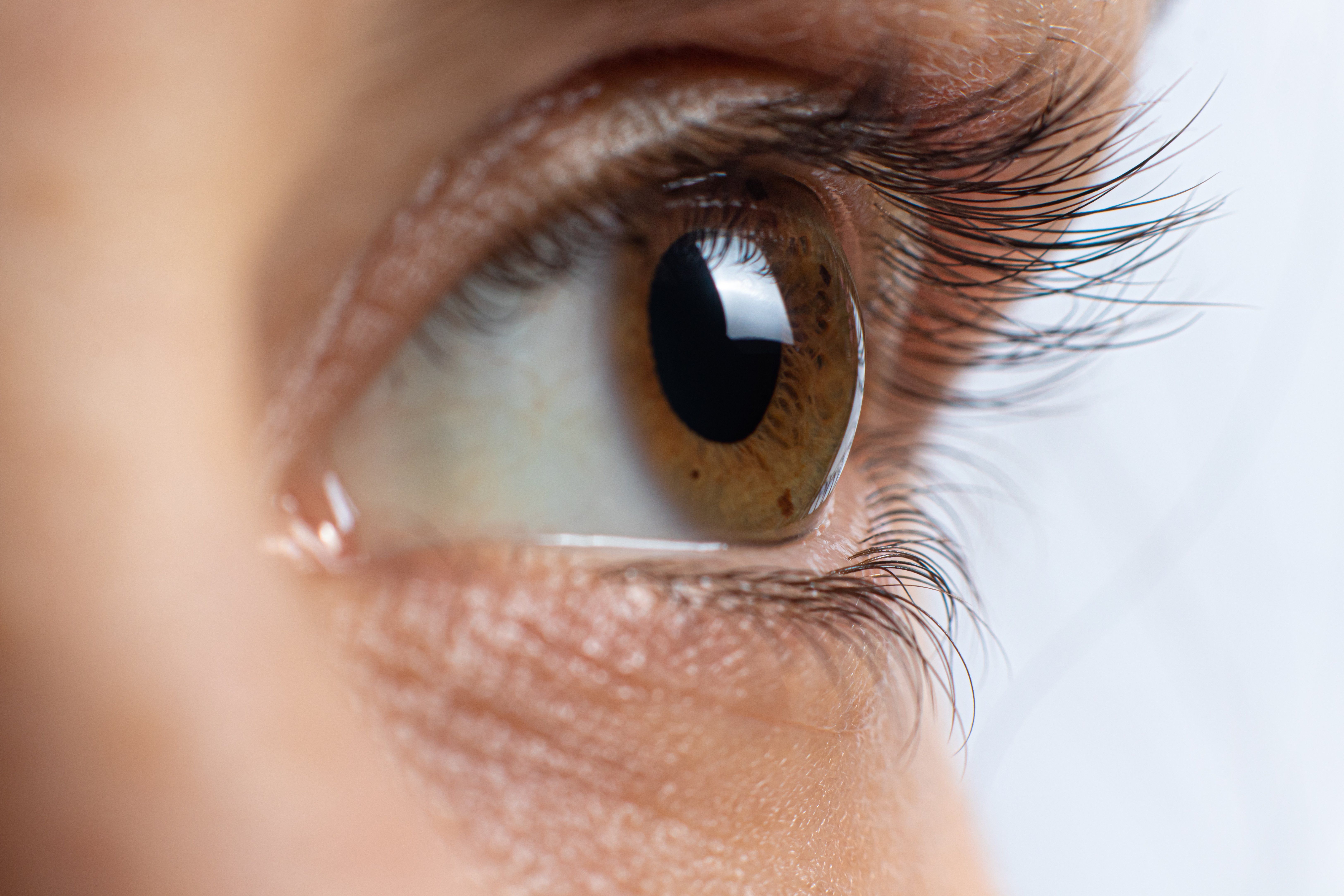 Why Specialty Contact Lenses Are Ideal If You Have Keratoconus