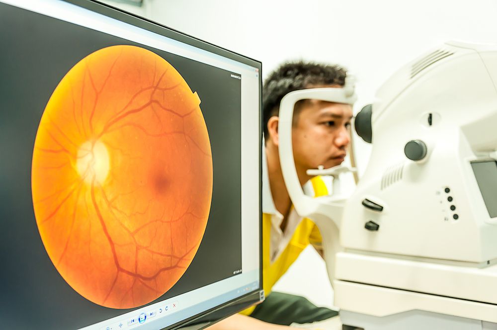 What Is an Optomap Retinal Exam?