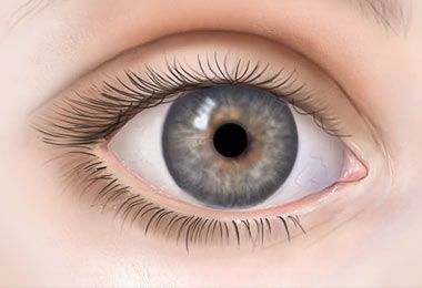Refractive Therapy