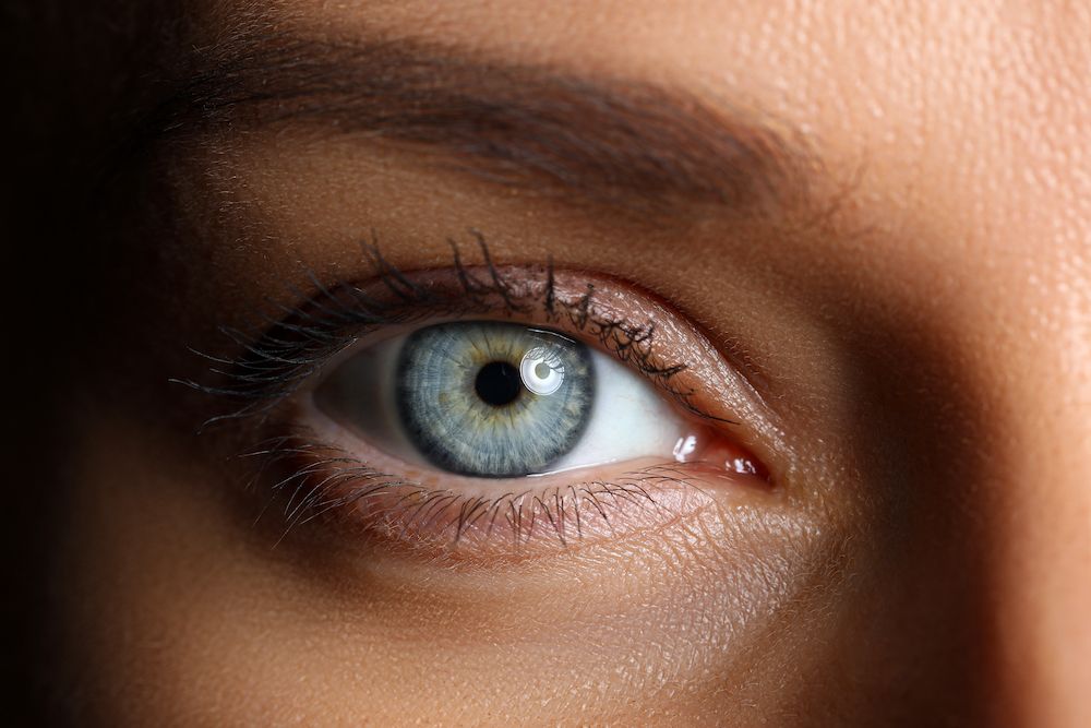 Who Can Benefit From Prosthetic Iris-Colored Lenses?