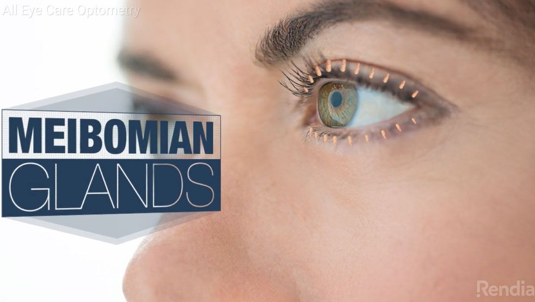 Meibomian Gland Dysfunction