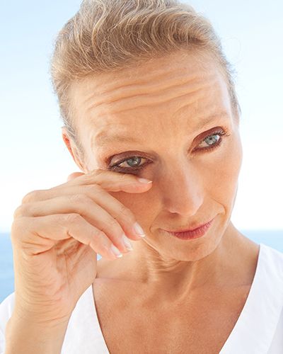 Woman with dry eye