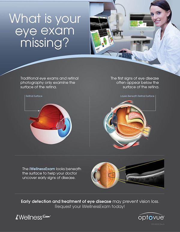 About Eye exams