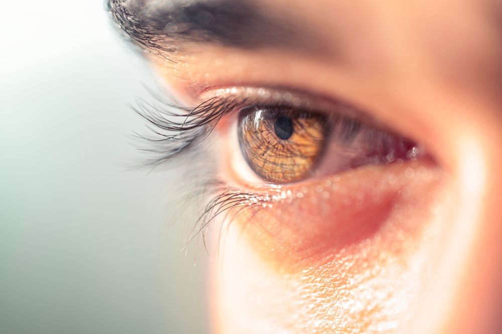 How IPL Treatments Can Alleviate Dry Eye Syndrome