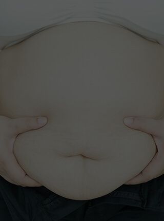 Post Bariatric