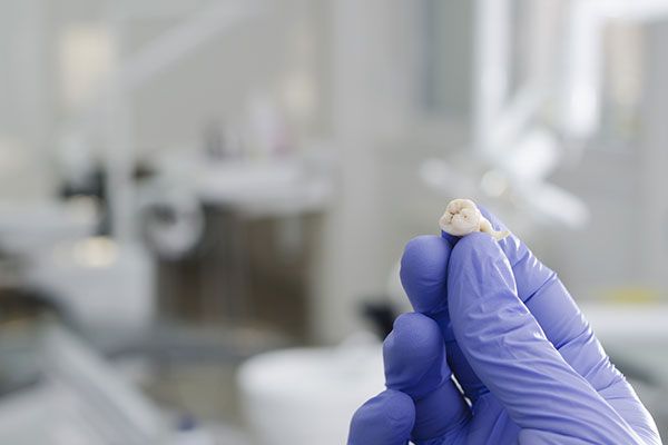 Dentist holding a tooth after extraction