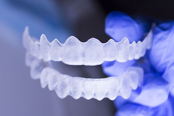 Invisalign