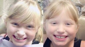kids teeth