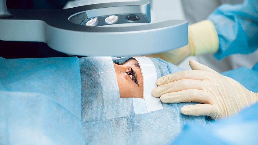 Cataract Surgery