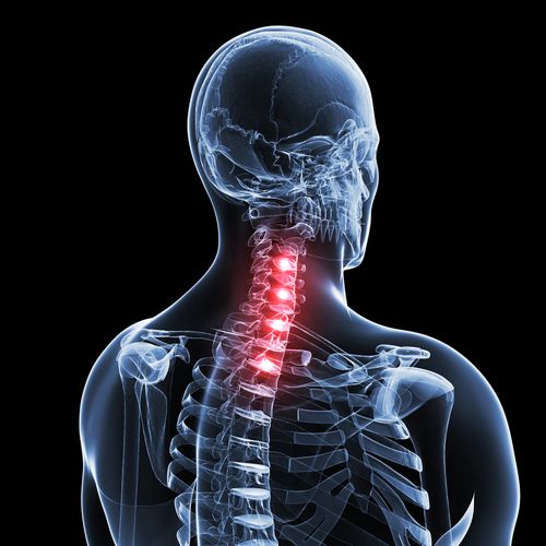 CONDITIONS NECK PAIN We Care Chiropractic