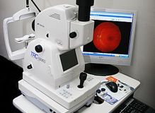 Retinal Camera