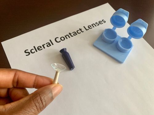 Wearing Scleral Lenses: 5 Things to Expect