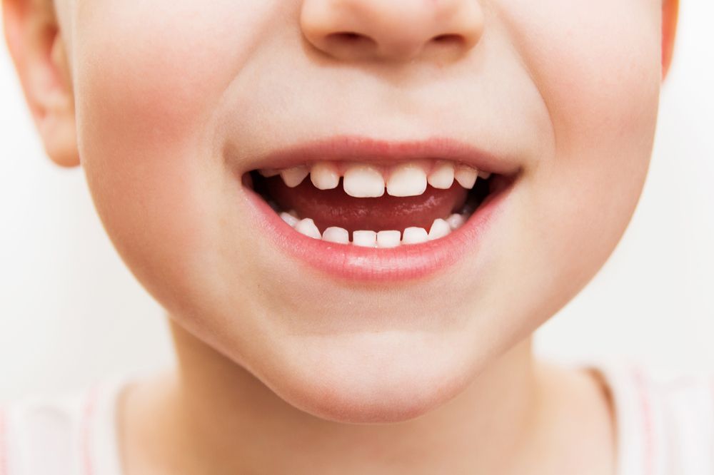 What Happens if Your Child's Baby Teeth aren't Falling Out