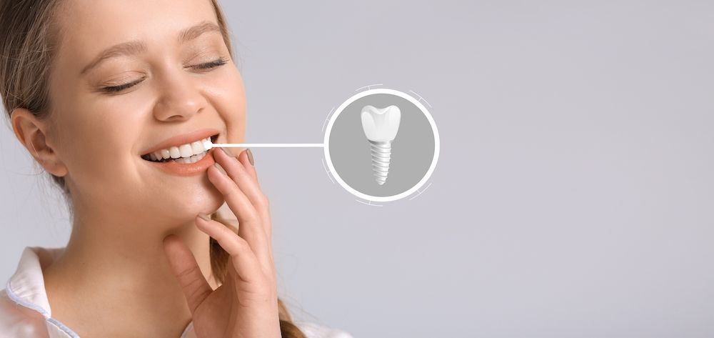 Temporary Habits After You Have Had A Dental Implant Surgery