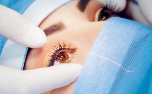 Considering LASIK as a viable treatment for astigmatism-information from your Orange County, California specialist